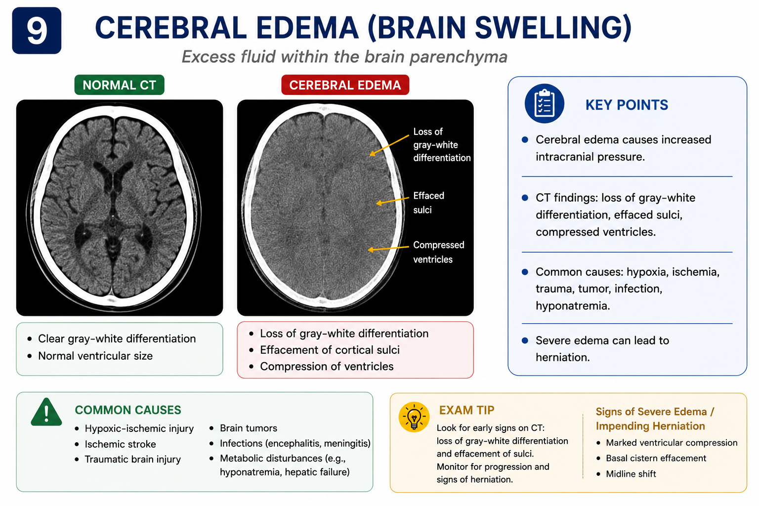 Diffuse cerebral oedema on CT